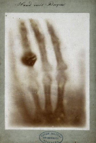 اولین تصویری که توسط اشعه  X گرفته شد