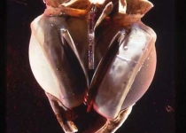 اولین قلب مصنوعی جهان/عکس
